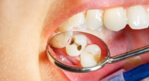 kücükcekmece_kanal_tedavisi, küçükçekmece implant, küçükçekmece diş beyazlatma, küçükçekmece şeffaf plak, küçükçekmece ortodonti, küçükçekmece diş hekimi, küçükçekmece diş kliniği, sefaköy diş hekimi, sefaköy diş kliniği, küçükçekmece ortodonti doktoru, sefaköy ortodonti doktoru