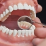 Protez Dişlerin Bakımı Nasıl Olmalı?