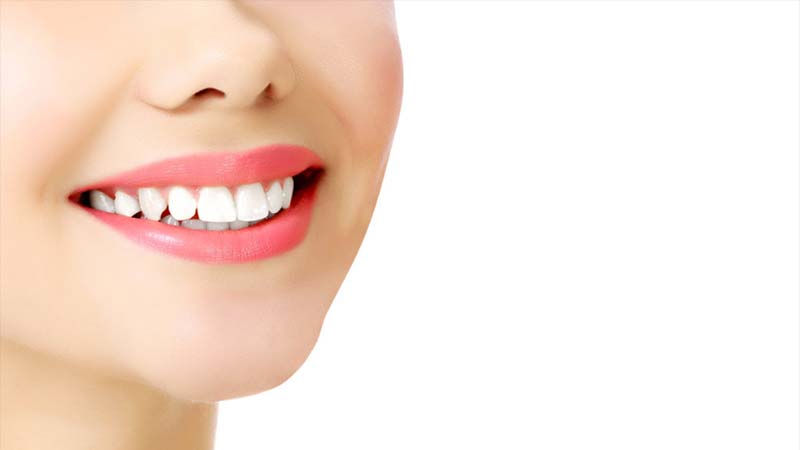 Halkalı Diş Kliniği, Diş Estetiği