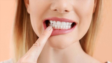 Sefaköy Diş Doktoru, Diş Taşı Temizliği
