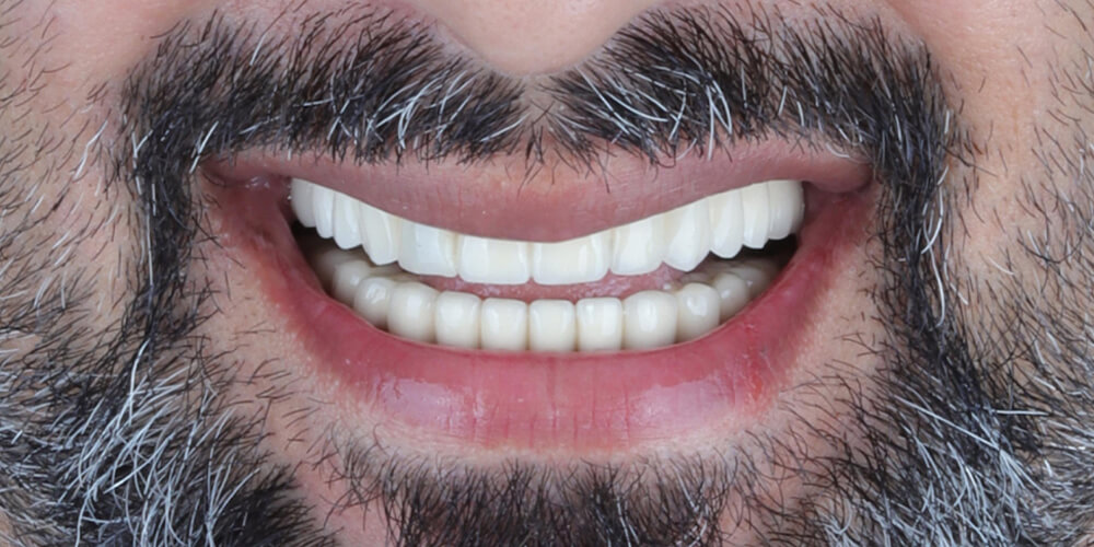 13-s-1000x500 13-s-1000x500