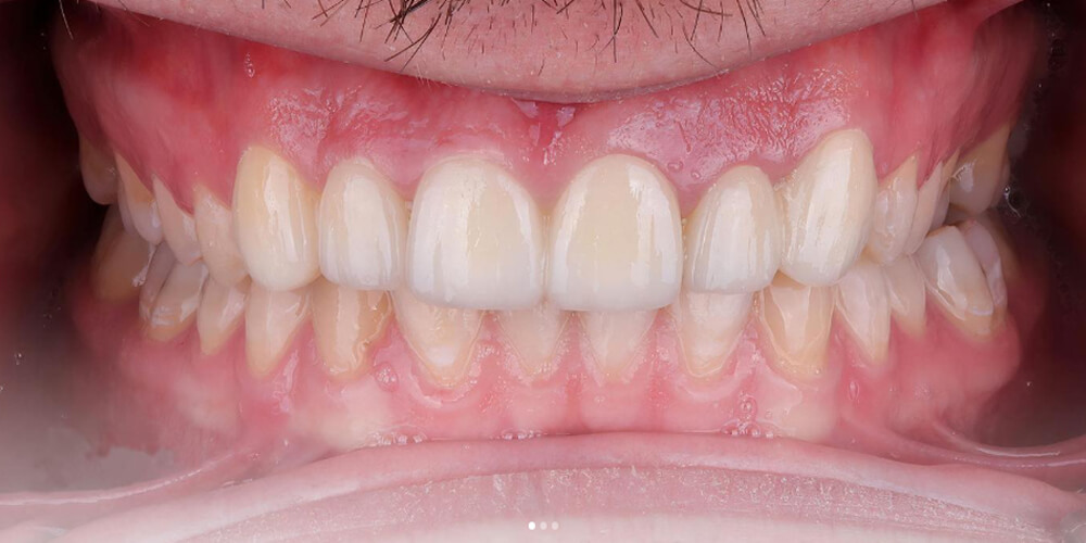 2-s-1000x500 2-s-1000x500