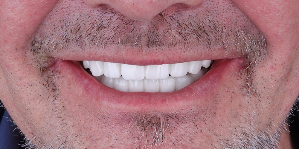 5-s-1000x500 5-s-1000x500