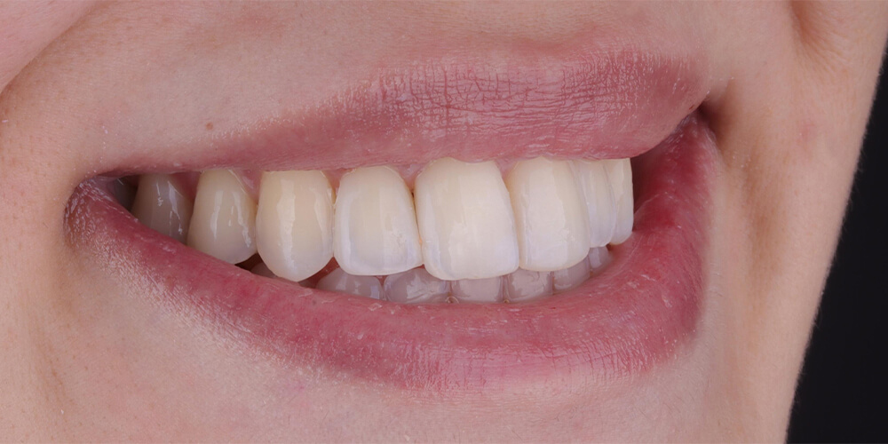 8-s-1000x500 8-s-1000x500