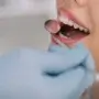 Diş Hastalıkları Dil Sararmasına Neden Olur mu?
