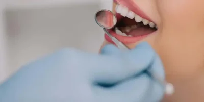 Diş Hastalıkları Dil Sararmasına Neden Olur mu?